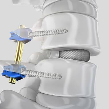 Product Picture CW Enlargement-PROSPACE® 3D Oblique