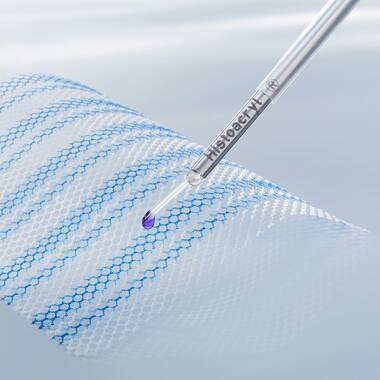 Product Picture Enlargement CW-Histoacryl® LapFix