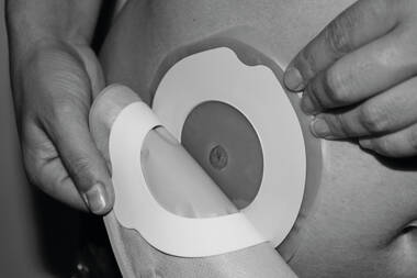 Application2-Flexima® / Softima® Key Closed